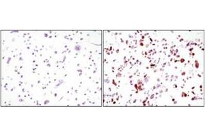 Immunohistochemistry (IHC) image for anti-Green Fluorescent Protein (GFP) antibody (ABIN1107357)