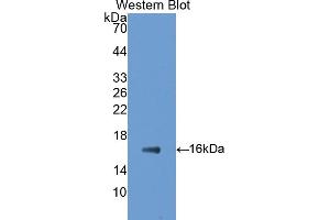 Western blot analysis of the recombinant protein. (GAD anticorps  (AA 1-97))
