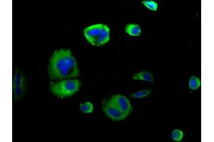 Immunofluorescence staining of MCF-7 cells with ABIN7168803 at 1:166, counter-stained with DAPI. (SEMA4D/CD100 anticorps  (AA 756-862))