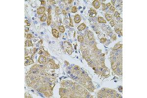 Immunohistochemistry of paraffin-embedded human stomach using TRPA1 antibody (ABIN5996346) at dilution of 1/100 (40x lens). (TRPA1 anticorps)