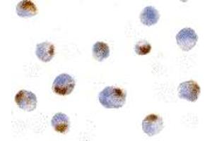 Immunohistochemistry (IHC) image for anti-Apoptotic Chromatin Condensation Inducer 1 (ACIN1) (Middle Region) antibody (ABIN1030843) (ACIN1 anticorps  (Middle Region))