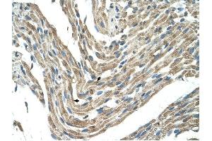 FBXL5 antibody was used for immunohistochemistry at a concentration of 4-8 ug/ml to stain Skeletal muscle cells (arrows) in Human Muscle.