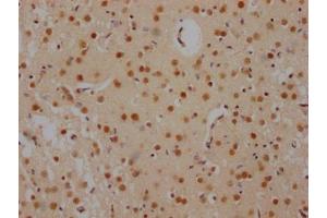 IHC image of ABIN7127503 diluted at 1:100 and staining in paraffin-embedded human brain tissue performed on a Leica BondTM system.