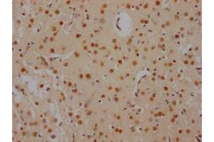 IHC image of ABIN7127503 diluted at 1:100 and staining in paraffin-embedded human brain tissue performed on a Leica BondTM system. (Recombinant FUBP1 anticorps)