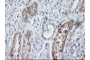 Immunohistochemical staining of paraffin-embedded Human Kidney tissue using anti-SIRT5 mouse monoclonal antibody. (SIRT5 anticorps)
