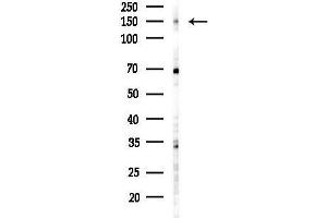 anti-Fanconi Anemia Complementation Group I (FANCI) (C-Term) antibody