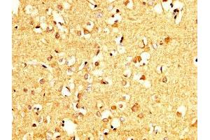 IHC image of ABIN7166420 diluted at 1:200 and staining in paraffin-embedded human brain tissue performed on a Leica BondTM system.