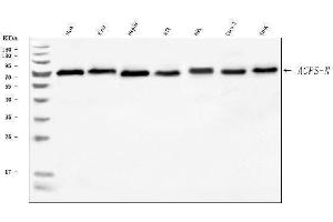 Western blot analysis of AGPS using anti-AGPS antibody (ABIN7600146). (AGPS anticorps  (AA 154-658))