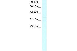 WB Suggested Anti-ASGR2 Antibody Titration:  4. (Asialoglycoprotein Receptor 2 anticorps  (N-Term))