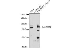 Immunoprecipitation analysis of 600 μg extracts of Rat testis cells using 3 μg FB2 antibody (ABIN7267111).