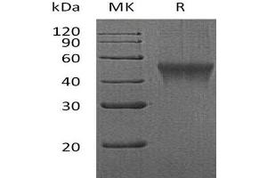 Western Blotting (WB) image for Fc Receptor-Like 1 (FCRL1) (AA 17-219) protein (His tag) (ABIN7320698)