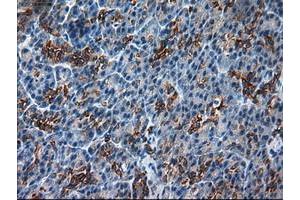 Image no. 11 for anti-Keratin 18 (KRT18) (AA 69-372) antibody (ABIN1491637)