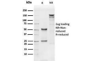 SDS-PAGE Analysis Purified CD31 Mouse Monoclonal Antibody (PECAM1/3540). (CD31 anticorps  (AA 625-738))
