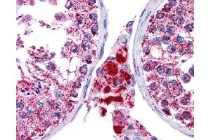 SFTPC antibody was used for immunohistochemistry at a concentration of 4-8 ug/ml. (Surfactant Protein C anticorps  (N-Term))