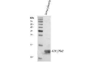 Western blot analysis of Hemoglobin using anti-Hemoglobin antibody (ABIN5518839).