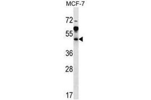 ARFIP1 Antibody (Center) western blot analysis in MCF-7 cell line lysates (35µg/lane). (ARFIP1 anticorps  (Middle Region))