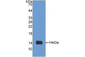 Detection of Recombinant OLFM4, Rat using Polyclonal Antibody to Olfactomedin 4 (OLFM4) (Olfactomedin 4 anticorps  (AA 405-511))