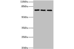 Western blot All lanes: ZNF699 antibody at 2 μg/mL Lane 1: Jurkat whole cell lysate Lane 2: K562 whole cell lysate Lane 3: U87 whole cell lysate Secondary Goat polyclonal to rabbit IgG at 1/10000 dilution Predicted band size: 74 kDa Observed band size: 74 kDa (ZNF699 anticorps  (AA 19-195))