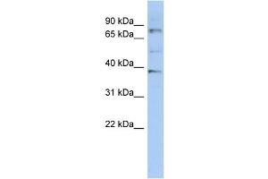 WB Suggested Anti-OAS2 Antibody Titration:  0. (OAS2 anticorps  (N-Term))