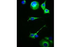 Immunofluorescence staining of MCF-7 cells with ABIN7159217 at 1:100, counter-stained with DAPI. (MC5 Receptor anticorps  (AA 1-37))