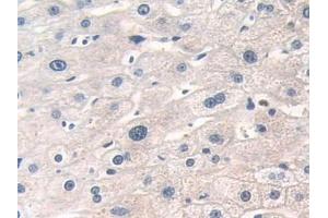 Detection of DOK3 in Human Liver Tissue using Polyclonal Antibody to Docking Protein 3 (DOK3)