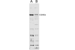 ABIN185714 staining of HFF cell lysate with B) 100nM siRNA or A) control siRNA. (SECISBP2 anticorps  (Internal Region))