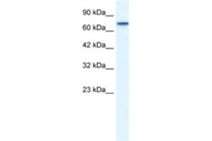 Western Blotting (WB) image for anti-Nuclear Receptor Subfamily 4, Group A, Member 1 (NR4A1) antibody (ABIN2460327)