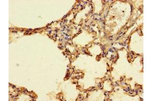 Immunohistochemistry of paraffin-embedded human lung tissue using ABIN7156574 at dilution of 1:100 (IFI27L2 anticorps  (AA 87-130))