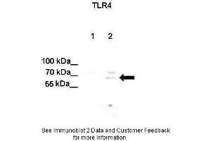 Lanes:  Lane 1: Untreated human U251 cell lysate Lane 2: IL-1beta treated human U251 cell lysate Primary Antibody Dilution:  1:500 Secondary Antibody:  Anti-rabbit-HRP Secondary Antibody Dilution:  1:500 Gene Name:  TLR4 Submitted by:  Anonymous (TLR4 anticorps  (C-Term))