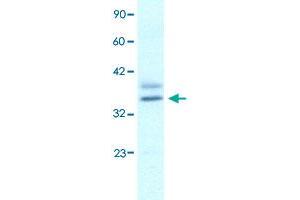 Western Blot analysis of Jurkat cell lysate with EHF polyclonal antibody  at 1. (EHF anticorps  (N-Term))