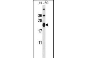 CD3E Antibody (C-term) (ABIN657454 and ABIN2846481) western blot analysis in HL-60 cell line lysates (35 μg/lane).
