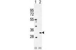 Western blot analysis of PRDX4 (arrow) using rabbit polyclonal PRDX4 Antibody (Center) .