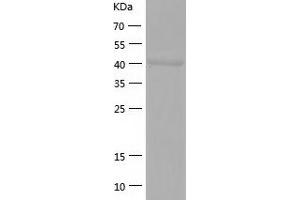 Western Blotting (WB) image for Glutaryl-CoA Dehydrogenase (GCDH) (AA 45-438) protein (His-IF2DI Tag) (ABIN7123126)