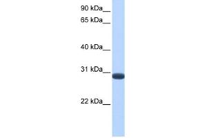 WB Suggested Anti-DUSP19 Antibody Titration: 0. (DUSP19 anticorps  (C-Term))