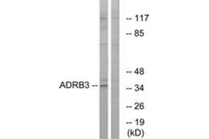 Western blot analysis of extracts from K562 cells, using ADRB3 Antibody.