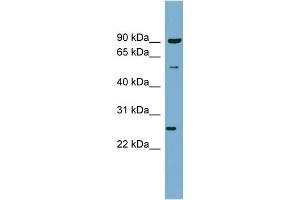 WB Suggested Anti-VAMP7 Antibody Titration:  0. (VAMP7 anticorps  (N-Term))