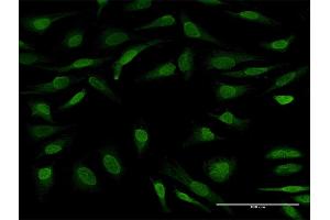 Immunofluorescence of purified MaxPab antibody to UBL7 on HeLa cell. (UBL7 anticorps  (AA 1-380))