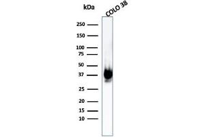 Western Blot Analysis of COLO-38 cell lysate using gp100 Rabbit Recombinant Monoclonal Antibody (PMEL/1825R). (Recombinant Melanoma gp100 anticorps)