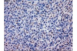 Immunohistochemical staining of paraffin-embedded lung using anti-EpCAM (ABIN2452677) mouse monoclonal antibody. (EpCAM anticorps  (AA 24-265))