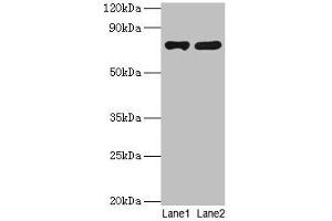 Western blot All lanes: PARN antibody at 2 μg/mL Lane 1: Jurkat whole cell lysate Lane 2: A431 whole cell lysate Secondary Goat polyclonal to rabbit IgG at 1/10000 dilution Predicted band size: 74, 67, 68, 53 kDa Observed band size: 74 kDa (PARN anticorps  (AA 1-639))