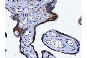 IHC analysis of YWHAE using anti-YWHAE antibody (ABIN7599165). (YWHAE anticorps  (AA 1-255))