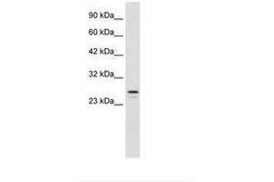 Image no. 2 for anti-Ring Finger Protein 2 (RNF2) (AA 228-277) antibody (ABIN202134) (RNF2 anticorps  (AA 228-277))