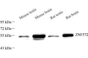 Western blot analysis of ZNF572 (ABIN7076268) at dilution of 1: 2000 (ZNF572 anticorps)