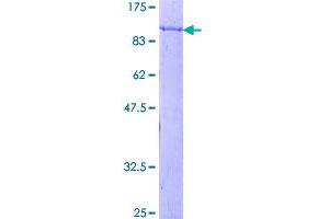Image no. 1 for Sorting Nexin 1 (SNX1) (AA 1-522) protein (GST tag) (ABIN1320852)