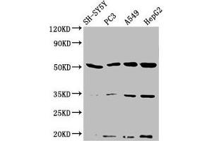 Western Blot Positive WB detected in: SH-SY5Y whole cell lysate, PC-3 whole cell lysate, A549 whole cell lysate, HepG2 whole cell lysate All lanes: NAGPA antibody at 3. (NAGPA anticorps  (AA 327-438))