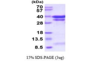 Cathepsin B (CTSB) (AA 18-339) (Active) protein (His tag)