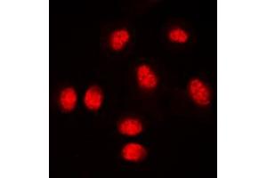 Immunofluorescent analysis of RUNX1 staining in THP1 cells. (RUNX1 anticorps  (Center))