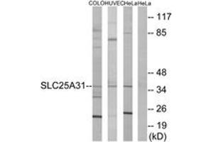 Western blot analysis of extracts from HeLa/HuvEc/COLO cells, using SLC25A31 Antibody.