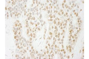 anti-PAXIP1 Associated Glutamate-Rich Protein 1 (PAGR1) (AA 204-254) antibody