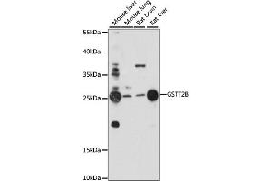 Western blot analysis of extracts of various cell lines, using GSTT2B antibody. (GSTT2B anticorps)